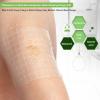 imageHydrocolloid Bandages Hydrocolloid Wound Dressing Thin Type 4x4 for Dry to Light Exudate Wound Bed Sore Pressure Ulcer Minor Burns Abrasions Cuts 10 Packs from NeuHeils4x4 Thin