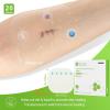 imageNeuHeils Hydrocolloid Bandages 4x4 Inch  20 Pack Hydrocolloid Thin Wound Dressing for Light Exudates Pressure Ulcers Bed Sores Minor Burns Cuts ampamp Abrasions Blister ampamp Surgical Wound Care4x4 20 Packs
